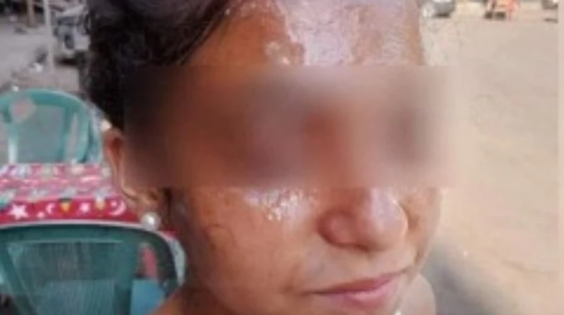 تحرك جديد ضد المتسببة في تشويه وجه الطالبة كارولين قال رفعت سعدان محامي الطالبة كارولين مرقس إن محكمة جنح العمرانية، قضت اليوم بحبس موظفة بالشؤون