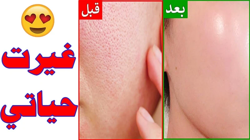 طريقة عمل غسول طبيعي لتفتيح لون البشرة والجسم وإزالة أي بقع أو تصبغات تعتبر طريقة تحضير وتجهيز نوع من أنواع الغسول الطبيعي في المنزل هي الأفضل والأصح لك للاستمتاع ببشرة نضرة وصافية