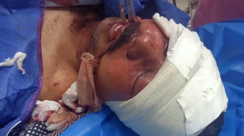 مدفوعا بالشك.. عاطل يعتدي بوحشية على صديقه بكفر البطيخ اعتدى عاطل بمركز كفر البطيخ، على بائع خضار، بوحشية، وقطع عضوه الذكري، على الطريق الدولي السريع