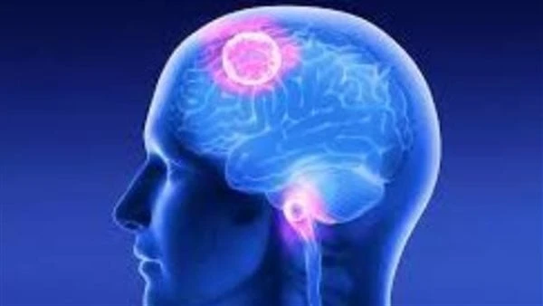 لن تتوقع تناول هذه الأطعمة يساعد على تعزيز وظائف المخ عندما يتعلق الأمر بتعزيز قوة الدماغ والمخ وتعزيز الذاكرة، تقدم الطبيعة بعض الحلول المبهجة