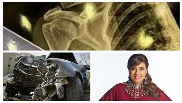 الدنيا متسواش.. نشوى مصطفى تتعرض لحادث سير تعرضت الفنانة نشوى مصطفى لحادث سير مروع نجت منه بصعوبة، ونشرت صورا من الأشعة عقب الحادث، وأرفقتها