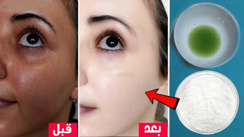 بشرتك هتبقى زي القشطة..وصفة لتبيض البشرة والجسم كله وإزالة البقع والتصبغات والتجاعيد من اول استعمال من الممكن التخلص من عدة مشكلات تتعلق باسمرار البشرة عن طريق استعمال المكونات الط