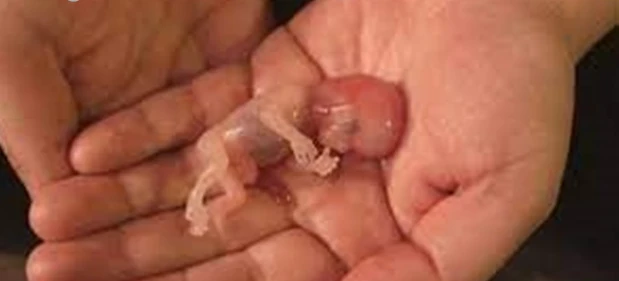 أهم 10 تفسيرات عن الإجهاض في المنام لابن سيرين الإجهاض في المنام، تعتبر تلك الرؤية من أكثر الأشياء التي تبث القلق والذعر بداخل الشخص الرائي، ولكنه