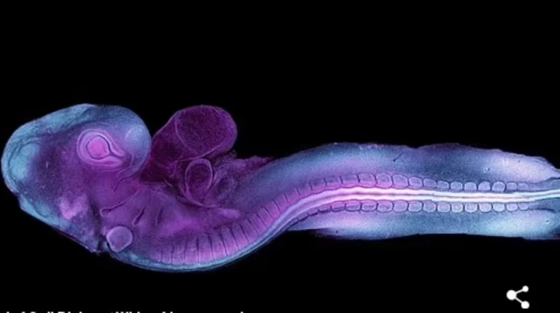 كشف طبي مذهل يحل لغز العيوب الخلقية لدى الأجنة تمكن العلماء من التقاط أول حالة لتشكل الجنين في مراحله المبكرة في مقطع فيديو، وهو ما يساعد على حل لغز