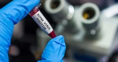 ولاية هندية تكثف استعداداتها الصحية بعد وفاة طفل بعدوى نيباه صحة وطب شاهد المقال التالي من صحافة مصر عن ولاية هندية تكثف استعداداتها الصحية بعد وفاة