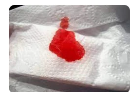 ما تفسير حلم الدورة الشهرية للعذراء؟ تفسير حلم الدورة الشهرية للعذراء، إن رؤية الدورة الشهرية من الرؤى التي تثير التعجب والحيرة عند الكثير من النساء،