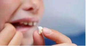 ما هو تفسير تساقط الأسنان في الحلم لابن سيرين؟ ما هو تفسير تساقط الأسنان في الحلم لابن سيرين؟، من الرؤى الغير محمودة لأن العلماء جميعهم اتفقوا على