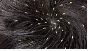 تعرف على تفسير حلم القمل الابيض لابن سيرين تفسير حلم القمل الابيض قد يكون إشارة إلى العديد من الدلالات المرتبطة بحياة الرائي، وذلك وفقا لما يراه من