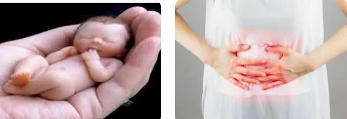 حلمت أني أجهضت وشفت الجنين وأنا لست حامل لابن سيرين حلمت أني أجهضت وشفت الجنين وأنا لست حامل لابن سيرين، تحملك تلك الرؤية الكثير من الدلالات والمعاني