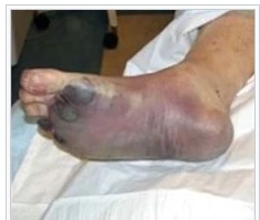 تأويلات ابن سيرين لرؤية الاكتحال في المنام الاكتحال في المنام، إن رؤية الاكتحال والكحل من الرؤى التي لاقت استحسانا واسعا عند غالبية الفقهاء، ومع ذلك