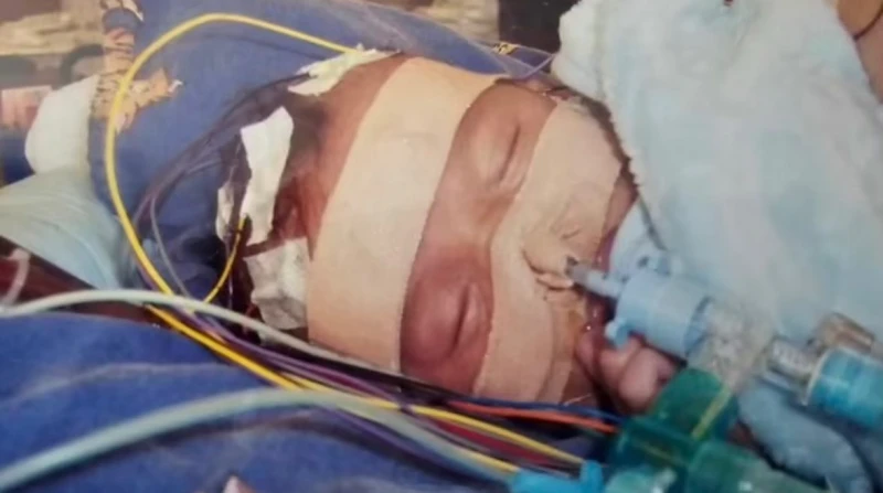 إصابة رضيع بتلف في الدماغ.. ما علاقة السعال الديكي؟ مع انتشار السعال الديكي بين الأطفال في بريطانيا، تم إصابة طفل صغير بتلف في الدماغ، ونشرت والدته قصته لتوعية باقي الأمهات باتخاذ