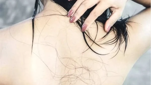 من 50 ل 100.. عوامل تزيد تساقط الشعر عن المعدل الطبيعي تساقط الشعر أمر طبيعي، وذلك لأن الشخص الطبيعي يفقد حوالي من 50 إلى 100 شعرة في اليوم، ولا