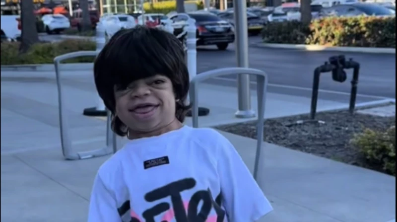 أصحاب متلازمة هنتر.. عائلة مجدي المعجباني تشعل تيك توك استطاع الطفل مجدي وشقيقه عمر المصابان بمتلازمة هنتر، ووالدتهما الطبيبة ابتسام مجدي، خطف أنظار