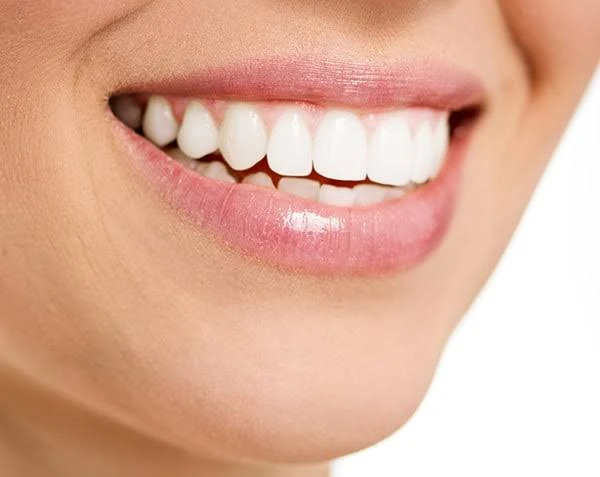 أسباب تسوس الأسنان وكيفية الوقاية منها.تعتبر تسوسات الأسنان من المشاكل الشائعة التي يعاني منها الكثير من الأشخاص حول العالم. يمكن أن تسبب التسوسات