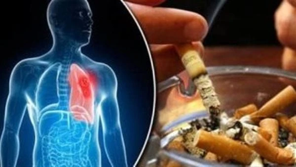 بنصائح بسيطة.. احمي نفسك وأسرتك من سرطان الرئةسرطان الرئة نوع من السرطانات، ويبدأ في الرئتين، والرئة عبارة عن إسفنجيين في صدرك يسحبان الأكسجين عند