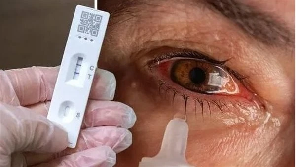 مرض خطير ماهو التهاب الملتحمة وإليك أهم أسباب الإصابة به مرض التهاب الملتحمة هو عدوى تصيب نسيج رقيق وشفاف يغطي الجزء الأبيض من العين ويبطن الجزء الداخلي من الجفن ورغم أنه يبدأ عادة