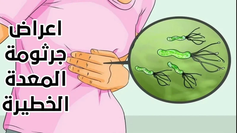 كل ما تحتاج معرفته عن جرثومة المعدة.. الأسباب والأعراض وطرق الوقاية والعلاج يطلق على جرثومة المعدة الكثير من الألقاب مثل الهضمية أو الحلزونية، أو البكتيرية، وهي التي تعيش في المعدة
