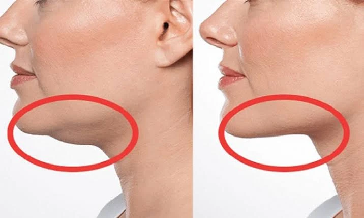 حيل للتخلص من الذقن المزدوج بدون تجميل.يعاني بعض النساء من الذقن المزدوج، مما يضطرهن الى الخضوع لجراحة تجميلية وشد الرقبة للتخلص منه، ولكن لحسن الحظ