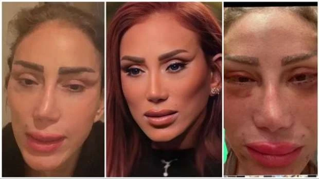 صور ريهام سعيد قبل وبعد عملية التجميل الأخيرةصور ريهام سعيد قبل وبعد عملية التجميل، أثارت ريهام سعيد موجة كبيرة بسبب التغيير الصادم في ملامحها بعد