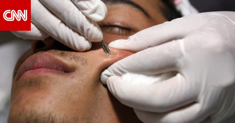 يثور الوجه ليست كلها متشابهة..إليك 4 أنواع مختلفة منها تكنولوجيا شاهد المقال التالي من صحافة الأفاق عربيةية عن يثور الوجه ليست كلها متشابهة إليك 4