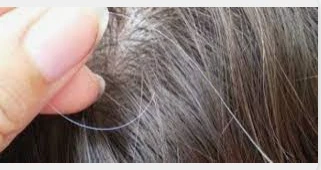 تعرف على تفسير حلم الشيب في الشعر لابن سيرين تفسير حلم الشيب في الشعر، من أكثر الأحلام التي يرغب الرائي في التعرف على دلالاتها ورموزها فإن الشيب يكون