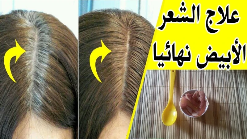 الشيب هيختفي.. وصفة الليمون للقضاء على الشعر الأبيض وشيب الشعر المبكر بدون صبغات كيميائية ضارة يعتبر الليمون من أهم المكونات التي تدخل في تحضير الكثير من الوصفات لتجميل الشعر والبش