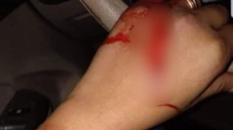 قرار النيابة في واقعة الاعتداء على محامية بالإسكندرية (خاص) أمرت نيابة المنشية الجزئية بالإسكندرية، بعمل التحريات اللازمة لكشف ملابسات واقعة اتهام