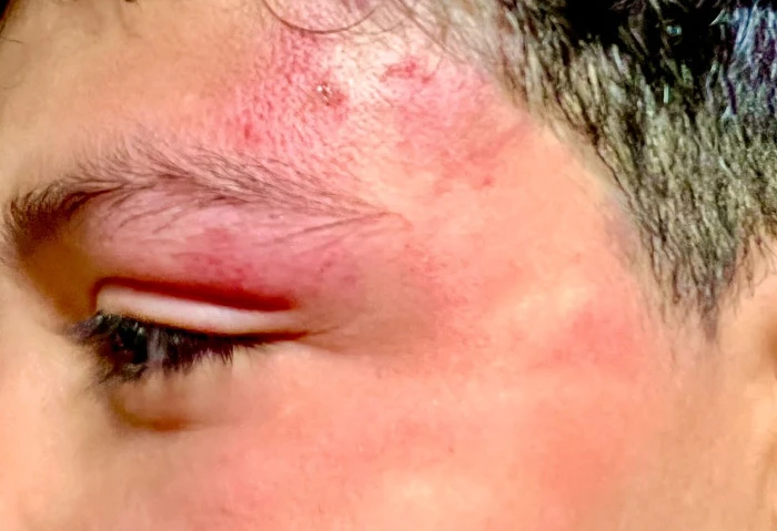 صفع نجل الإعلامية شذا شعبان على يد شاب بالساحل الشمالي تعرض طفل يدعى أحمد زكريا 12 سنة و4 أطفال آخرين للصفع باليد الحديدية من قبل شاب يدعى محمود . أ بالساحل الشمالي في مارينا 2 أثن