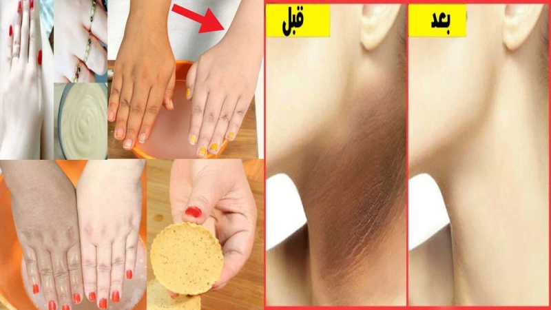 كولاجين لبان الدكر الطبيعي لشد البشرة وتفتيحها والتخلص من الجلد الميت والتجاعيد من اول استعمال من الممكن اتباع تلك الطريقة المقبلة لعمل خلطة شد