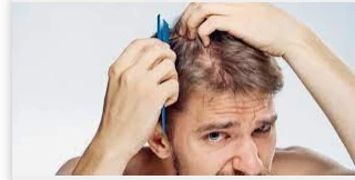 تفسير حلم تساقط الشعر للرجال لكبار العلماء تفسير حلم تساقط الشعر للرجال لكبار العلماء، يرى علماء تفسير الأحلام أن حلم تساقط الشعر للرجال يدل على خسارة الرجل المادية أو تعرضه للفشل،