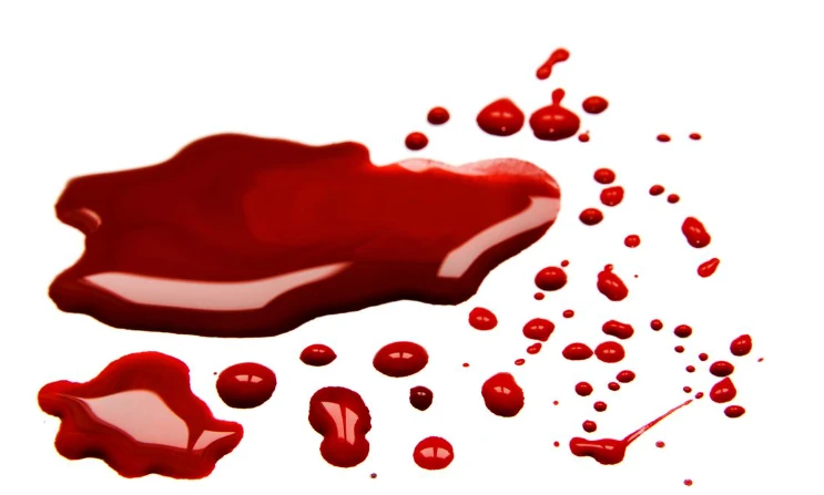 تعرف على تفسير رؤية الدم في المنام للمتزوجة ابن سيرين رؤية الدم في المنام للمتزوجة، إن رؤية الدم من الرؤى التي تسبب الفزع والقلق، ولا يحبب لدى الكثيرين منا رؤية الدم في اليقظة، كما