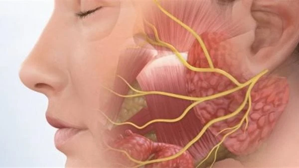 لا تهمل علاجه.. مضاعفات خطيرة تنتج عن الإصابة بالعصب السابعمرض العصب السابع أو كما يعرف شلل الوجة النصفي هو ضعف مفاجئ في عضلات الوجه يجعل نصف الوجه