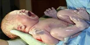 تفسيرات رؤية الولادة في المنام تفسيرات رؤية الولادة في المنام، على الرغم من أن الأطفال نعمة من الله تعالى وزينة الحياة الدنيا، ولكن كل امرأة ينتابها