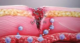 كيف تعمل الصفائح الدموية على إغلاق الجروح ؟: معجزة ربانيةكيف تعمل الصفائح الدموية على إغلاق الجروح ؟: معجزة ربانية-----