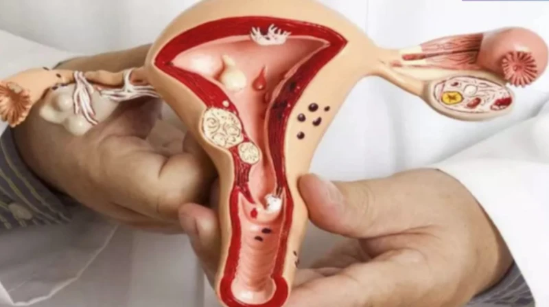 السرطان يلتهم رحم سيدة بسبب السدادات القطنية آلام مبرحة أسفل البطن أيقظتها من سباتها العميق، بكاء وصراخ أفزع زوجها خلال نومه، حيث أسرع بالنزول بها