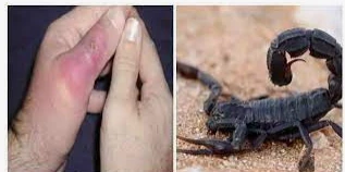 ما هو تفسير حلم قرصة العقرب لابن سيرين؟ ما هو تفسير حلم قرصة العقرب لابن سيرين؟، العقرب هو أحد العنكبويات التي يتشاءم الكثير منا عند رؤيتها سواء في