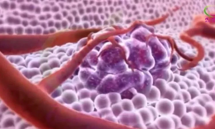 أعراض سرطان الثدي وطرق العلاج صحة شاهد المقال التالي من صحافة مصر عن أعراض سرطان الثدي وطرق العلاج، أعلنت وزارة الصحة عن طرق علاج سرطان الثدي، خاصة