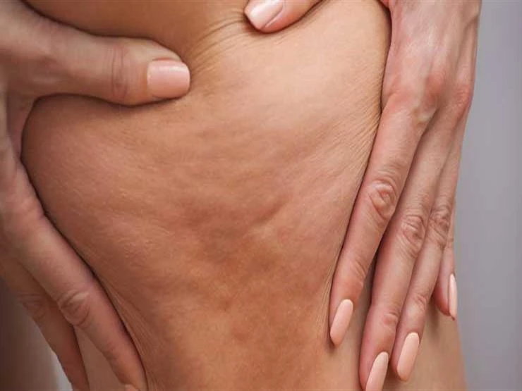 ما أسباب وعلاج السيلوليت؟ لايف ستايل شاهد المقال التالي من صحافة مصر عن ما أسباب وعلاج السيلوليت؟، 01 01 ص الإثنين 29 يوليو 2024 د ب أ كشفت مجلة