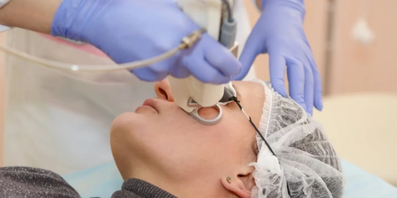 لبشرة صحية ونضرة كل ما تريدين معرفته عن تقشير الوجه بالليزر.أن تقشير الوجه بالليزر هي تقنية علاجية تهدف إلى تقشير الطبقة السطحية لبشرة الوجه وتحفيز