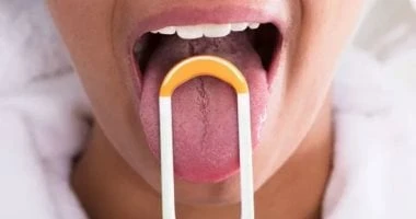 علامات على لسانك تكشف إصابتك بعدة أمراض.. منها البقع البيضاء صحة وطب شاهد المقال التالي من صحافة مصر عن علامات على لسانك تكشف إصابتك بعدة أمراض منها