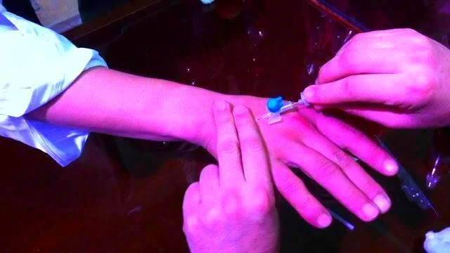 صور تركيب كانيولا 2025يحدث البلاء للإنسان بشكل دوري على مستويات مختلفة، ومن الناس من يحتاج للذهاب للمستشفى لتلقي العلاج، وبعض الحالات تحتاج لتعليق