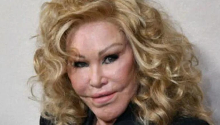 جوسلين وايلدنشتاين تكشف عن وجهها الحقيقي (صورة) افاق عربية - كشفت جوسلين وايلدنشتاين، صاحبة لقب كات وومان، عن وجهها الحقيقي في صورة التقطت قبل التحول