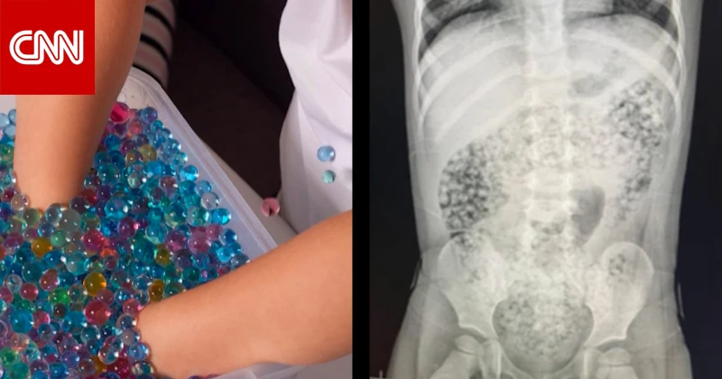 خطيرة للغاية.. تحذير من كرات الخرز المائي الشائعة بين الأطفال تكنولوجيا تكنولوجيا، خطيرة للغاية تحذير من كرات الخرز المائي الشائعة بين الأطفال،التحذيرات من كرات الخرز المائي ليست ب