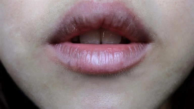 ما أسباب وعلاج البقع الصبغية على الشفاه؟ لايف ستايل شاهد المقال التالي من صحافة مصر عن ما أسباب وعلاج البقع الصبغية على الشفاه؟، ما أسباب وعلاج البقع