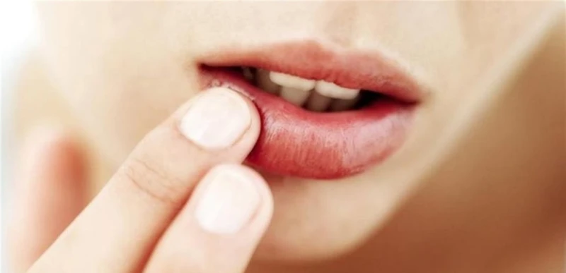 لمواجهة هربس الشفاه.. اليكم هذه النصائح صحة شاهد المقال التالي من صحافة لبنان عن لمواجهة هربس الشفاه اليكم هذه النصائح، لمواجهة هربس الشفاه اليكم هذه النصائح،بحسب ما نشر لبنان 24، 