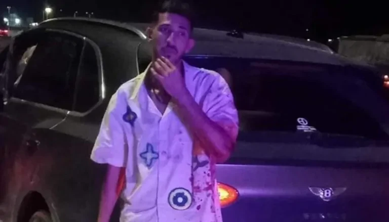 مفاجأة في واقعة فتوح تكشفها التحريات الأولية لم يستطع إيقاف السيارةفتوح , كشفت التحقيقات الأولية عن تفاصيل جديدة تتعلق بحادثة الدهس المتهم فيها لاعب