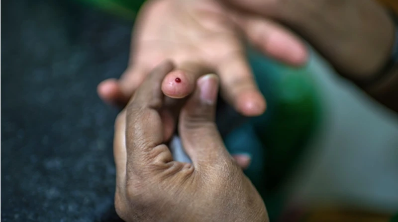 كعب داير على حقنة أنسولين.. ورئيس غرفة صناعة الدواء في ويك إند وجه مصفر وشفتان تلونت بالحبر الأزرق، وفقدان للوعي شبه كامل، بتلك الحالة دخل أحمد الفرماوي، البالغ من العمر 65 عاما، إ