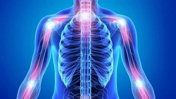 هؤلاء الأكثر عرضة للإصابة بمرض الروماتويد.. هل انت منهم؟التهاب المفاصل الروماتويدي هو مرض التهابي مزمن يمكن أن يؤثر على مناطق أخرى غير المفاصل مثل
