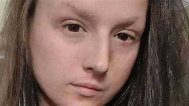 صدفة غيرت حياتها.. قصة سيدة تعاني من جلد السحلية منذ طفولتها (صور) لايف ستايل شاهد المقال التالي من صحافة مصر عن صدفة غيرت حياتها قصة سيدة تعاني من جلد السحلية منذ طفولتها صور، كتب