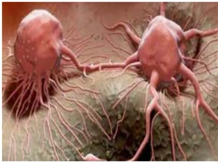 10 علامات تحذيرية تكشف عن خلايا سرطانية في الجسم.. لا تتجاهلها لايف ستايل لايف ستايل، 10 علامات تحذيرية تكشف عن خلايا سرطانية في الجسم لا تتجاهلها،02